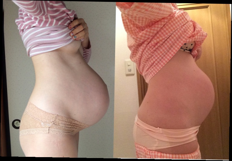 Итак слева фото за пару дней до родов 39 с копейками недель, а справа живот в первые сутки после родов!